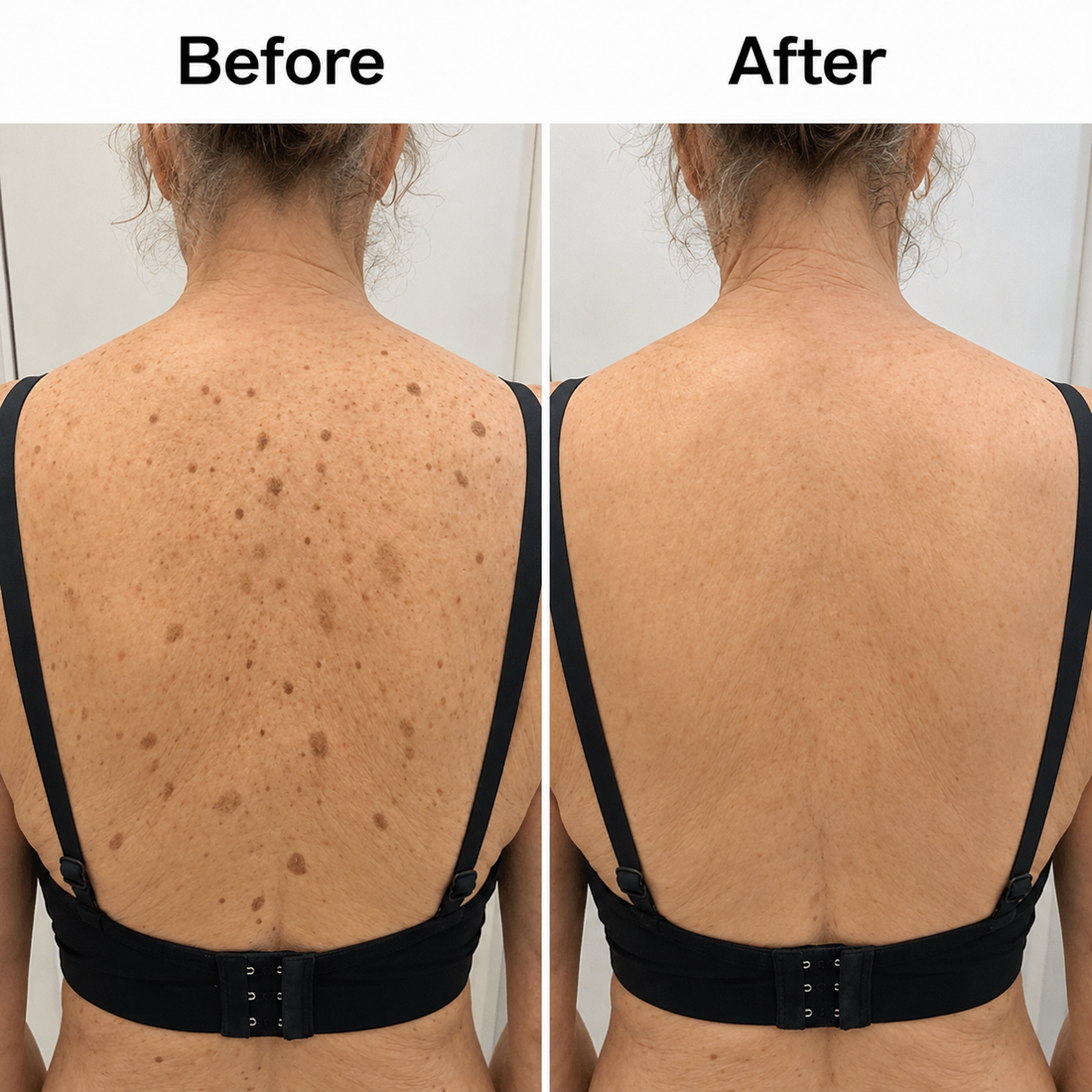 Darco™Glycolic Body Stick