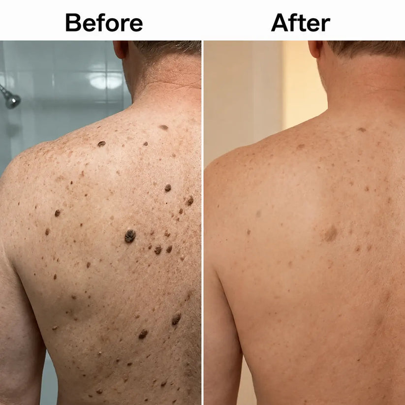 Darco™Glycolic Body Stick