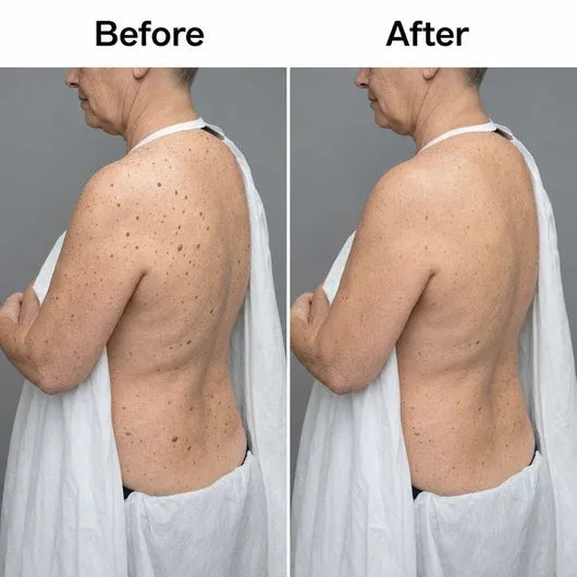 Darco™Glycolic Body Stick
