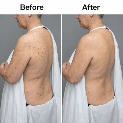 Darco™Glycolic Body Stick